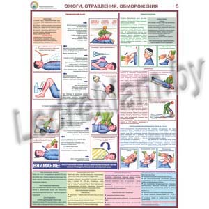 Стенд - плакат ожоги, отравления, обморожения
